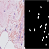 Example of Histopathology image and matched ground truth